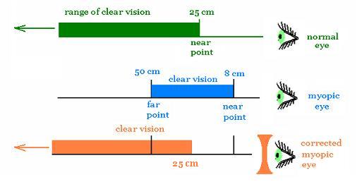 scheme of far/near points